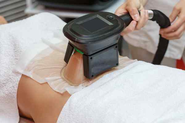 Areas of the Body we treat Cryolipolysis Poole
