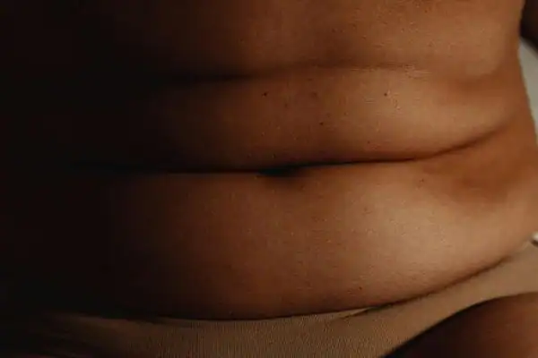 The Hidden Connection: How Stress Shapes Your Fitness and Body Composition 3 image of what stress can do on the stomach area and how Lipo 360 Poole can help to change your body shape.