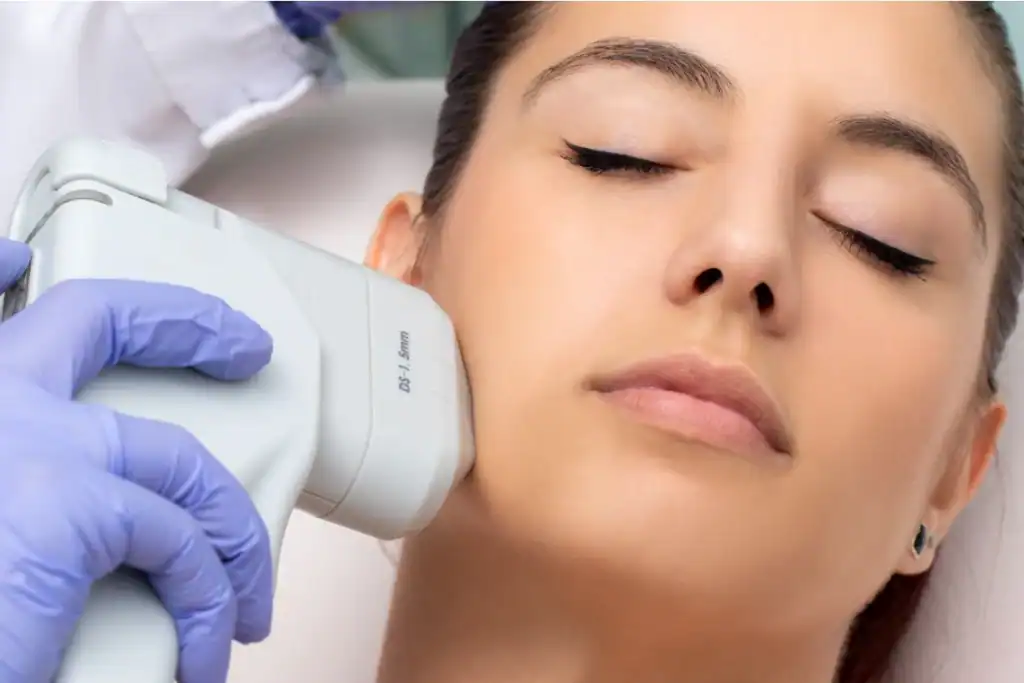Discover the Perfect Duo: RF Microneedling and HIFU 2 Image of Morpheus8 And HIFU Combined with Lipo 360 Poole