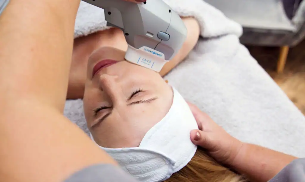 Discover the Perfect Duo: RF Microneedling and HIFU 1 Image of Morpheus8 And HIFU Poole combined treatment